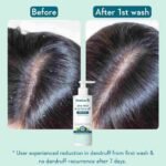 WishCare AHA BHA Anti-Dandruff Shampoo - Image 3